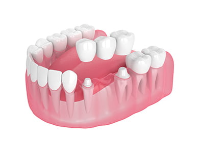 ブリッジ イメージ画像