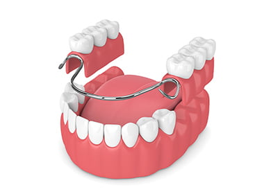 入れ歯 イメージ画像