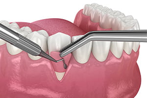 GBRイメージ画像